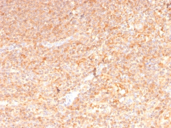IHC staining of FFPE human spleen with GM-CSF antibody (clone CSF2/3402). HIER: boil tissue sections in pH 9 10mM Tris with 1mM EDTA for 10-20 min and allow to cool before testing.