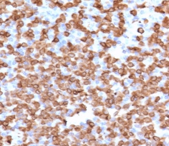 IHC staining of FFPE human spleen with CD11b antibody (clone CDLA11b-1). HIER: boil tissue sections in pH 9 10mM Tris with 1mM EDTA for 20 min and allow to cool before testing.
