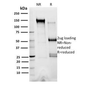 SDS-PAGE analysis of purified, BSA-free XRCC3 antibody (clone 10F1/6) as confirmation of integrity and purity.