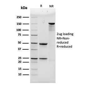 SDS-PAGE analysis of purified, BSA-free Alpha Actinin 4 antibody (clone 93) as confirmation of integrity and purity.