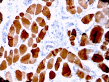 IHC staining of FFPE human skeletal muscle tissue with Actinin Alpha 2 antibody (clone ACTN2/3294). HIER: boil tissue sections in pH 9 10mM Tris with 1mM EDTA for 10-20 min and allow to cool before testing.