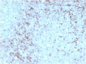 IHC staining of FFPE human spleen with recombinant CD3e antibody (clone rC3e/1931). HIER: boil tissue sections in pH 9 10mM Tris with 1mM EDTA for 10-20 min and allow to cool before testing.