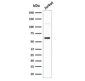 Western blot testing of human Jurkat cell lysate with CD63 antibody (clone LAMP3/2881). Predicted molecular weight: 25-60 kDa depending on glycosylation level.