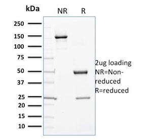 SDS-PAGE analysis of purified, BSA-free CYP3A1 antibody (clone P6) as confirmation of integrity and purity.