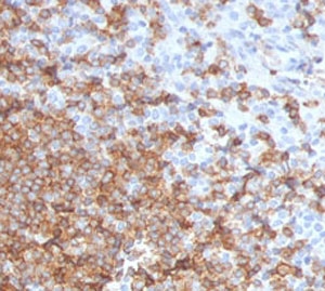 IHC staining of FFPE human tonsil with CD105 antibody (clone CDLA105-1). HIER: boil tissue sections in pH 9 10mM Tris with 1mM EDTA for 10-20 min and allow to cool before testing.