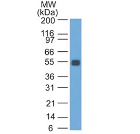 Western blot testing of rat colon lysate with EpCAM antibody. Expected molecular weight: ~35 kDa (unmodified), 40-43 kDa (glycosylated).