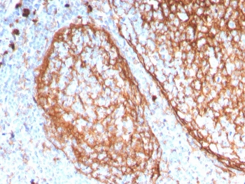 IHC staining of FFPE human tonsil with CD11b antibody (clone ITGAM/3338). HIER: boil tissue sections in pH 9 10mM Tris with 1mM EDTA for 20 min and allow to cool before testing.