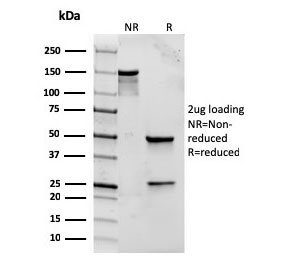 SDS-PAGE analysis of purified, BSA-free recombinant TLR2 antibody (clone rTLR2/221) as confirmation of integrity and purity.