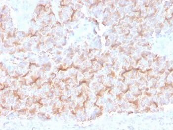IHC staining of FFPE human lung with Alpha Tubulin antibody (clone TUBA/3038). HIER: boil tissue sections in pH 9 10mM Tris with 1mM EDTA for 20 min and allow to cool before testing.
