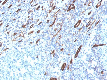 IHC staining of FFPE human tonsil with CD31 antibody (clone PECAM1/3525). HIER: boil tissue sections in pH 9 10mM Tris with 1mM EDTA for 20 min and allow to cool before testing.