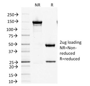 SDS-PAGE analysis of purified, BSA-free Factor XIIIa antibody (clone F13A1/1447) as confirmation of integrity and purity.