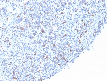 IHC staining of FFPE human tonsil with recombinant ITGAE antibody (clone rITGAE/2063). HIER: boil tissue sections in pH 9 10mM Tris with 1mM EDTA for 20 min and allow to cool before testing.
