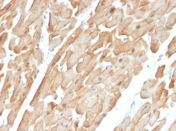 IHC staining of FFPE human cardiac muscle with Dystrophin antibody (clone DMD/3677). HIER: boil tissue sections in pH 9 10mM Tris with 1mM EDTA for 20 min and allow to cool before testing.