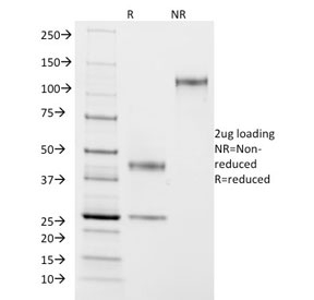SDS-PAGE analysis of purified, BSA-free ASRGL1 antibody (clone CRASH/1290) as confirmation of integrity and purity.