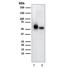 Western blot testing of human 1) K562 and 2) PC-3 cell lysate with PAI-RBP1 antibody. Predicted molecular weight ~45 kDa but observed at 45-60 kDa.