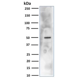 Western blot testing of human HEK293 cell lysate with CA9 antibody. Predicted molecular weight: 50-55 kDa but may be observed at higher molecular weights due to glycosylation.