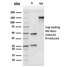 SDS-PAGE analysis of purified, BSA-free CD106 antibody (clone VCAM1/3499) as confirmation of integrity and purity.
