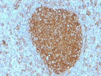 IHC staining of FFPE human tonsil with CD71 antibody (clone TFRC/3630). HIER: boil tissue sections in pH 9 10mM Tris with 1mM EDTA for 20 min and allow to cool before testing.