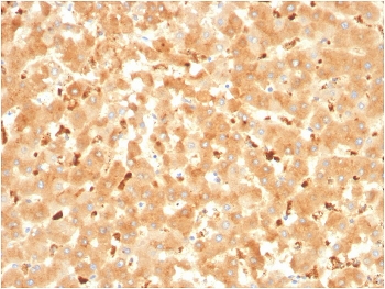 IHC staining of FFPE human liver with Alpha-2-Macroglobulin antibody. HIER: boil tissue sections in pH 9 10mM Tris with 1mM EDTA for 20 min and allow to cool before testing.