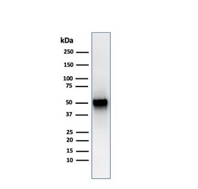 Western blot testing of human spleen lysate with recombinant PD-ECGF antibody (clone rTYMP/3444). Predicted molecular weight ~55 kDa.