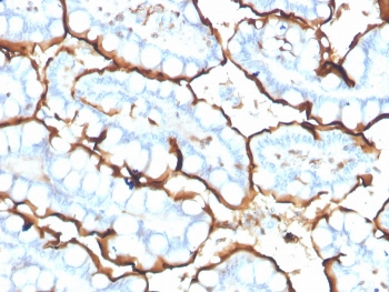 IHC staining of FFPE human small intestine with ACE antibody. HIER: boil tissue sections in pH 9 10mM Tris with 1mM EDTA for 20 min and allow to cool before testing.