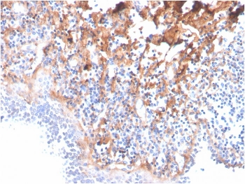 IHC staining of FFPE human tonsil with Fibronectin antibody (clone C6F10). HIER: boil tissue sections in pH 9 10mM Tris with 1mM EDTA for 20 min and allow to cool before testing.