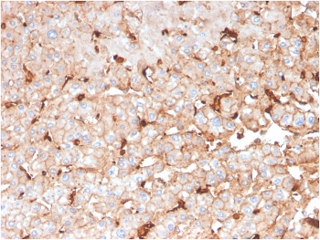 IHC staining of FFPE human liver with APOD antibody. HIER: boil tissue sections in pH 9 10mM Tris with 1mM EDTA for 20 min and allow to cool before testing.