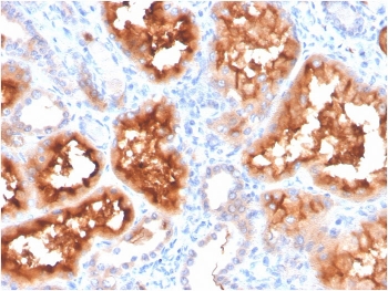 IHC staining of FFPE human kidney with Carbonic Anhydrase IX antibody. HIER: boil tissue sections in pH 9 10mM Tris with 1mM EDTA for 20 min and allow to cool before testing.