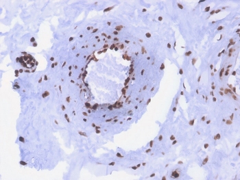 IHC staining of FFPE human colon with recombinant dsDNA antibody (clone rDSD/4565). HIER: boil tissue sections in pH 9 10mM Tris with 1mM EDTA for 20 min and allow to cool before testing.