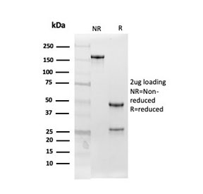 SDS-PAGE analysis of purified, BSA-free Follistatin antibody (clone FST/4282) as confirmation of integrity and purity.