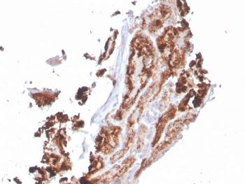 IHC staining of FFPE human kidney with RBP4 antibody. HIER: boil tissue sections in pH 9 10mM Tris with 1mM EDTA for 20 min and allow to cool before testing.