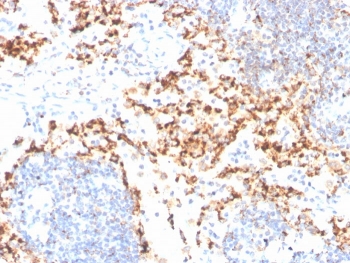 IHC staining of FFPE human tonsil with TIM3 antibody. HIER: boil tissue sections in pH 9 10mM Tris with 1mM EDTA for 20 min and allow to cool before testing.