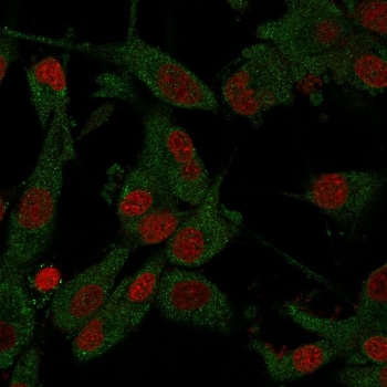 Immunofluorescent staining of PFA-fixed human U-87 MG cells with Amyloid Beta antibody (clone APP/3345, green) and Reddot nuclear stain (red).
