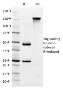 SDS-PAGE analysis of purified, BSA-free Helicobacter pylori antibody (clone HP/1334) as confirmation of integrity and purity.