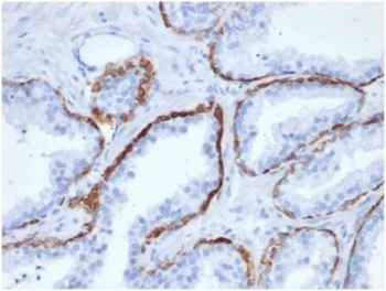 Ck5 CK5 Antibody | Cytokeratin 5 | Clone KRT5/6466 | V8794