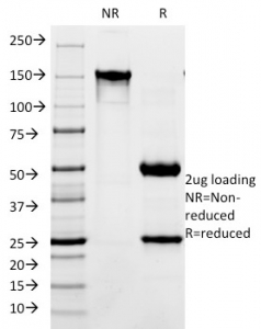 SDS-PAGE analysis of purified, BSA-free L1CAM antibody (clone SPM275) as confirmation of integrity and purity.