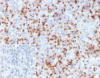 IHC staining of FFPE human spleen tissue with Resistin antibody (clone RETN/3331). Negative control inset: PBS used instead of primary antibody to control for secondary Ab binding. HIER: boil tissue sections in pH 9 10mM Tris with 1mM EDTA for 20 min and allow to cool before testing.