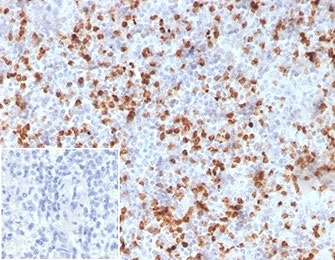 IHC staining of FFPE human spleen tissue with Resistin antibody (clone RETN/3331). Negative control inset: PBS used instead of primary antibody to control for secondary Ab binding. HIER: boil tissue sections in pH 9 10mM Tris with 1mM EDTA for 20 min and allow to cool before testing.