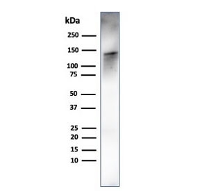 Western blot testing of human ovary tissue lysate using recombinant Caldesmon antibody (clone rCALD1/820). Predicted molecular weight ~93 kDa, can be observed at 70-80 kDa (non muscle tissue) and 120-150 kDa (smooth muscle).