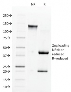 SDS-PAGE analysis of purified, BSA-free Angiotensin Converting Enzyme antibody (clone 9B9) as confirmation of integrity and purity.