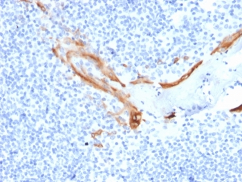 IHC staining of FFPE human tonsil tissue with KRT16 antibody (clone SPM264). HIER: boil tissue sections in pH 9 10mM Tris with 1mM EDTA for 20 min and allow to cool before testing.