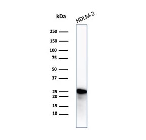 Western blot testing of human HDLM-2 cell lysate with recombinant Bcl-2 antibody. Predicted molecular weight ~26 kDa.