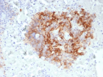 IHC staining of FFPE human lymph node with CD35 antibody (clone CR1/6380) at 2ug/ml. HIER: boil tissue sections in pH 9 10mM Tris with 1mM EDTA for 20 min and allow to cool before testing.