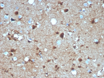 IHC staining of FFPE human brain tissue with S100B antibody (clone S100B/4139). HIER: boil tissue sections in pH 9 10mM Tris with 1mM EDTA for 20 min and allow to cool before testing.