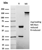 SDS-PAGE analysis of purified, BSA-free Penicillin antibody (clone Pen-9) as confirmation of integrity and purity.