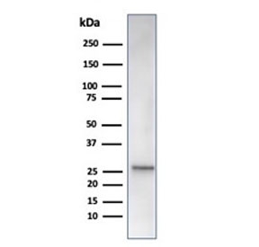 Western blot testing of human liver tissue lysate using recombinant HSPB1 antibody (clone rHSPB1/6489). Predicted molecular weight: 23-27 kDa.