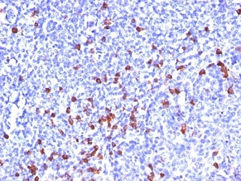 IHC: Formalin-fixed, paraffin-embedded human tonsil stained with Kappa Light Chain antibody (clone SPM508).