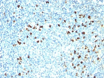 IHC: Formalin-fixed, paraffin-embedded human tonsil stained with anti-Kappa antibody (clone SPM558).