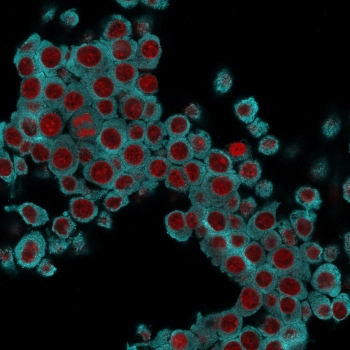 Immunofluorescent staining of fixed mouse RAW cells with Cytokeratin 6 antibody (clone SPM269, cyan) and Reddot nuclear stain (red).
