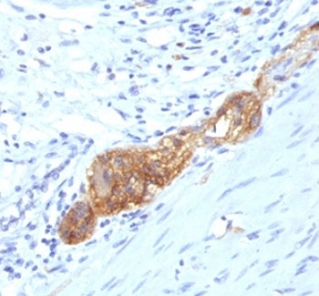 IHC: Formalin-fixed, paraffin-embedded human colon stained with anti-CD56 antibody (SPM489)